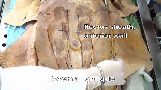 Anterior Abdominal Wall